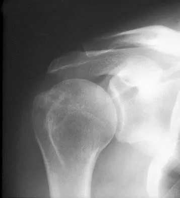 Upper Extremity 2026 MCQs: Board Review Questions & Answers (Part 3) - Figure 5