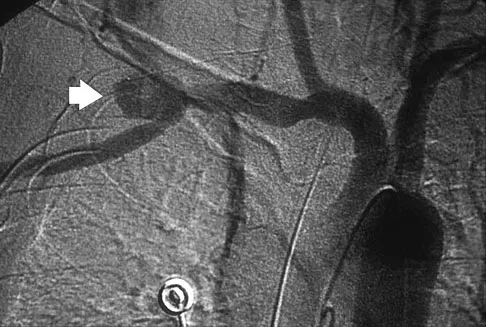 Upper Extremity 2026 MCQs: Board Review Questions & Answers (Part 3) - Figure 73