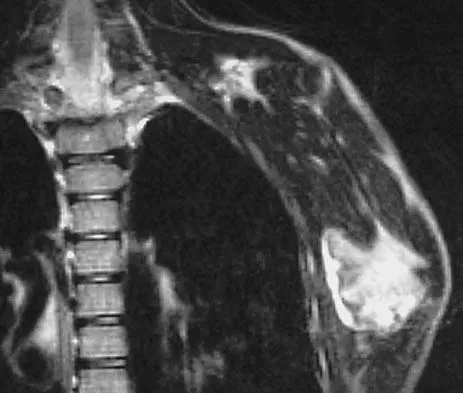 Upper Extremity 2026 MCQs: Board Review Questions & Answers (Part 4) - Figure 15