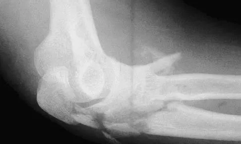 Upper Extremity 2026 MCQs: Board Review Questions & Answers (Part 4) - Figure 27