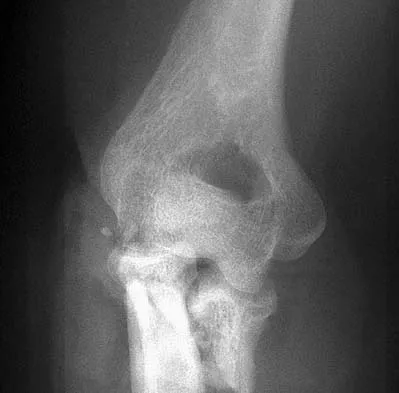 Upper Extremity 2026 MCQs: Board Review Questions & Answers (Part 4) - Figure 29