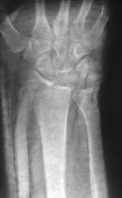 Upper Extremity 2026 MCQs: Board Review Questions & Answers (Part 5) - Figure 15