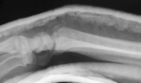 Upper Extremity 2026 MCQs: Board Review Questions & Answers (Part 5) - Figure 19
