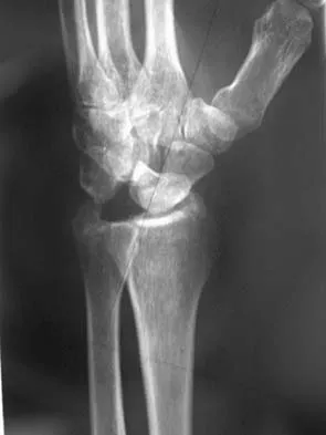 Upper Extremity 2026 MCQs: Board Review Questions & Answers (Part 5) - Figure 23