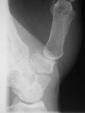 Upper Extremity 2026 MCQs: Board Review Questions & Answers (Part 5) - Figure 27