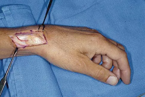 Upper Extremity 2026 MCQs: Board Review Questions & Answers (Part 5) - Figure 39