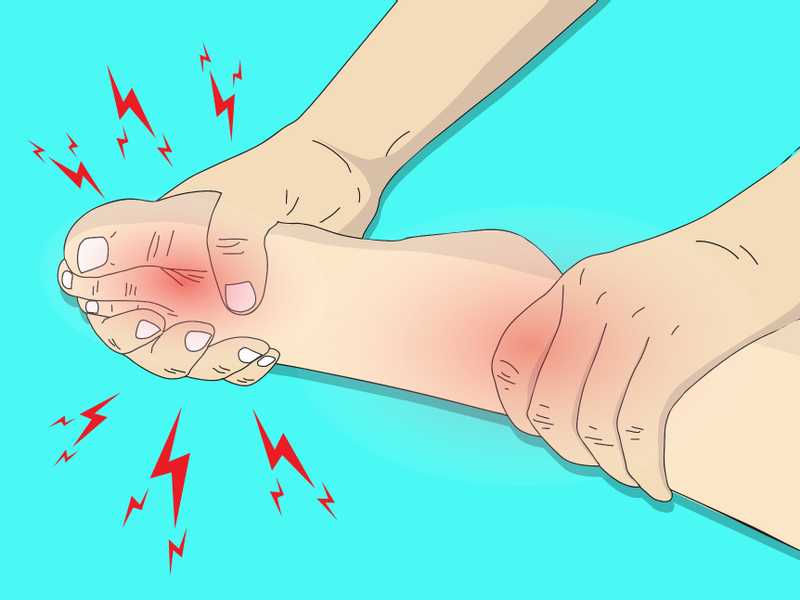 الدليل الشامل لمرض النقرس الكاذب (CPPD): الأعراض، التشخيص، وخيارات العلاج المتقدمة مع البروفيسور محمد هطيف