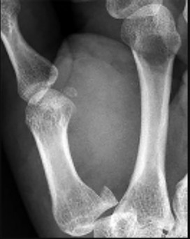 Orthopedic Hand MCQs: View Abstract & Master Cases from PubMed PMID