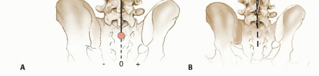 Illustration 13 for Adult Scoliosis: Uncover Causes & Find Lasting Back Pain Relief