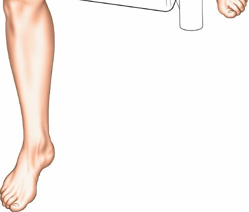 Illustration 4 for Mastering Knee Approaches: Spotlight on Superficial Medial Ligament