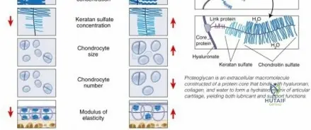 Illustration of cartilage and joint - Dr. Mohammed Hutaif