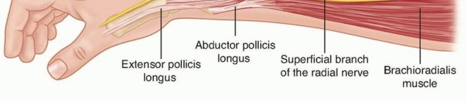 Illustration 2 for Effective K-Wire Fixation: Distal Radius Fractures Without External Fixation
