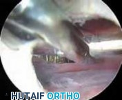 Illustration 24 for J. W. Thomas on Snapping Hip: Causes, Cures & Relief