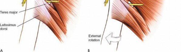 Illustration 30 for Essential Guide: Mastering Every Approach to the Shoulder