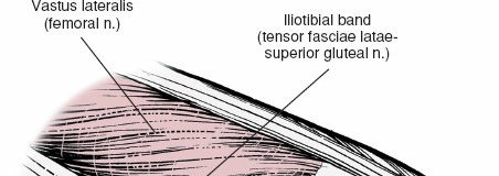 Illustration 144 for Mastering Knee Approaches: Spotlight on Superficial Medial Ligament