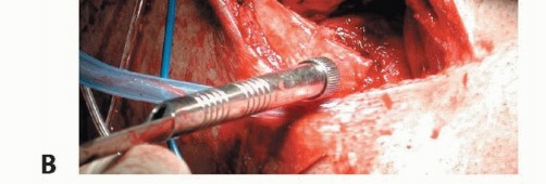 Illustration 19 for Repair & Recover from Collateral Ligament Injuries: Your Guide