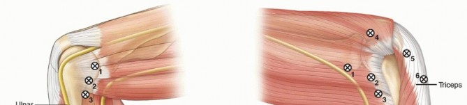 Elbow Arthroscopy: The Basics