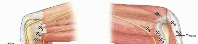 تنظير مفصل المرفق: دليل شامل للمرضى نحو الشفاء التام مع الأستاذ الدكتور محمد هطيف