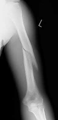 Illustration 78 for OrthoCash: Trauma MCQs & Cases for a yearold woman