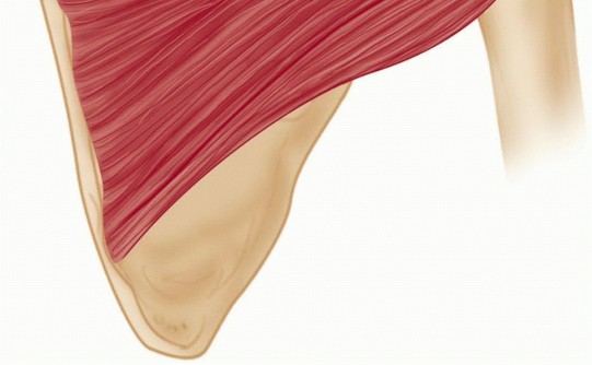 Illustration 14 for Mastering the Treatment of Recurrent Posterior Shoulder Instability
