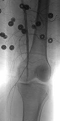 Illustration 166 for OrthoCash: Trauma MCQs & Cases for a yearold woman