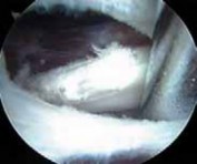 Illustration 27 for J. W. Thomas on Snapping Hip: Causes, Cures & Relief