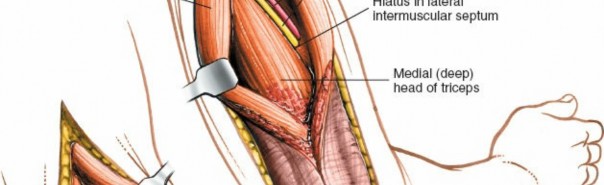 Illustration 41 for Mastering the Approach to the Distal Humerus: Safety & Skills