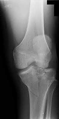 Illustration 161 for OrthoCash: Trauma MCQs & Cases for a yearold woman