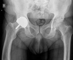 Structured Hip Oral Examination: Master This Complex Case