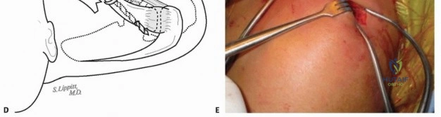 ABOS Part I & OITE Orthopaedic Review: Hand Surgery MCQs on Trigger Finger & Carpal Tunnel | Part 21555