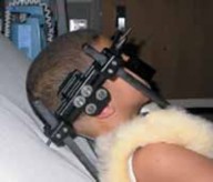 Illustration 19 for Cervical Fusion: The Line is Drawn for Lasting Stability