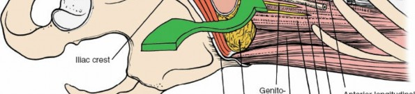 Illustration 7 for Master the Anterolateral Retroperitoneal Approach to Lumbar Spine