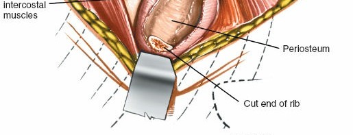 Illustration 302 for Approach to the Lumbar Spine: Mastering Techniques & Anatomy