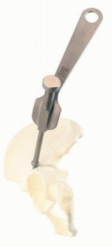 Illustration 13 for Cemented Acetabular Component: Achieving Optimal THA Stability