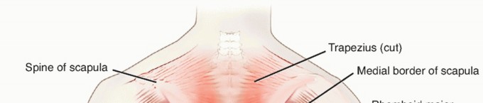 Understanding the Rami of Spinal Nerves in Posterior Approaches
