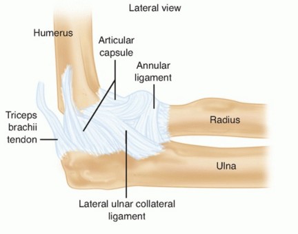 Complex Elbow Instability: Repairing Head and Coronoid Fractures