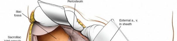 Illustration 23 for Ilioinguinal Approach: Master the Deep Inguinal Ring for Success