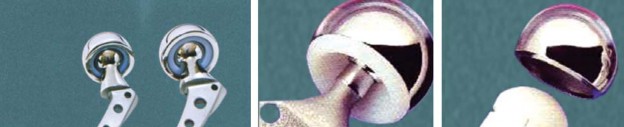 Illustration 8 for Mastering Hip Arthroplasty: Its Evolution and Design Unveiled