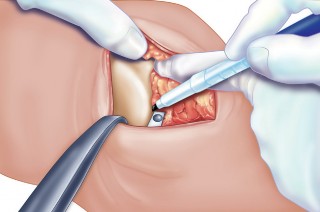 وصف طبي دقيق للمريض