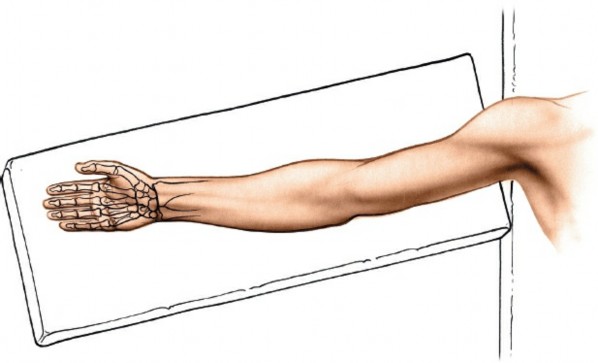 Illustration of aspect of the distal - Dr. Mohammed Hutaif
