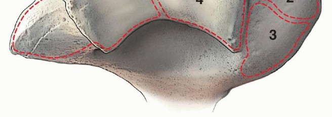 Illustration 4 for Navigating Capitellum and Capitellar-Trochlear Shear Fracture Repair