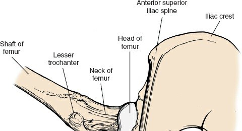 Illustration 229 for Unlocking Every Aspect of the Hip's Surgical Approaches