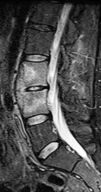 Illustration 19 for OrthoCash: Trauma MCQs & Cases for a yearold woman