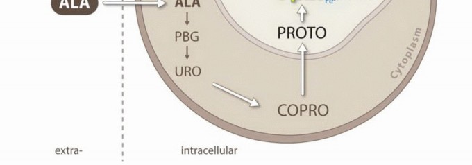Illustration 3 for Targeted Ablation of Musculoskeletal Tumors: A Safer Approach