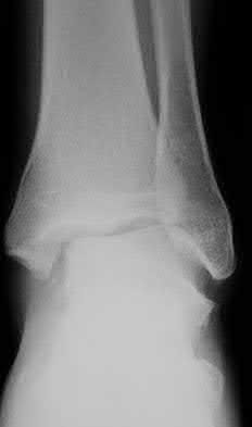 Illustration 58 for OrthoCash: Trauma MCQs & Cases for a yearold woman