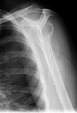 Illustration 150 for OrthoCash: Trauma MCQs & Cases for a yearold woman