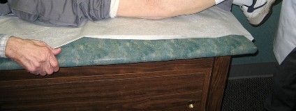 Illustration 12 for Hinged Total Knee: The Salvage Solution for Challenging Cases