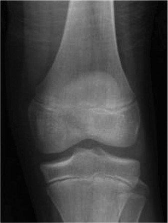 Solve 17 Challenging Pediatrics Cases for Clinical Success