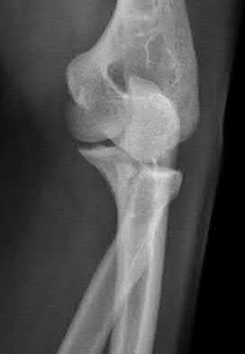 Illustration 37 for OrthoCash: Trauma MCQs & Cases for a yearold woman