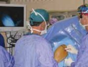 Unlocking Shoulder Arthroscopy: Your Head and Glenoid Guide